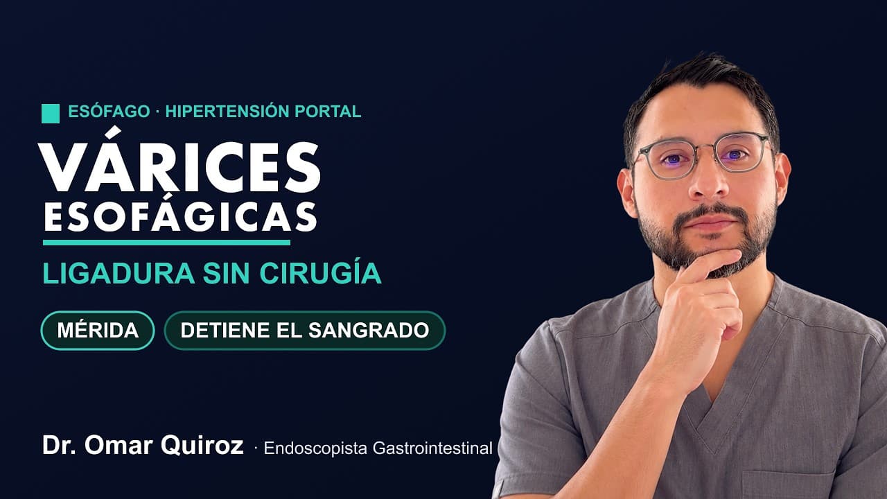 Ligadura de Várices Esofágicas en Mérida | Dr. Omar Quiroz